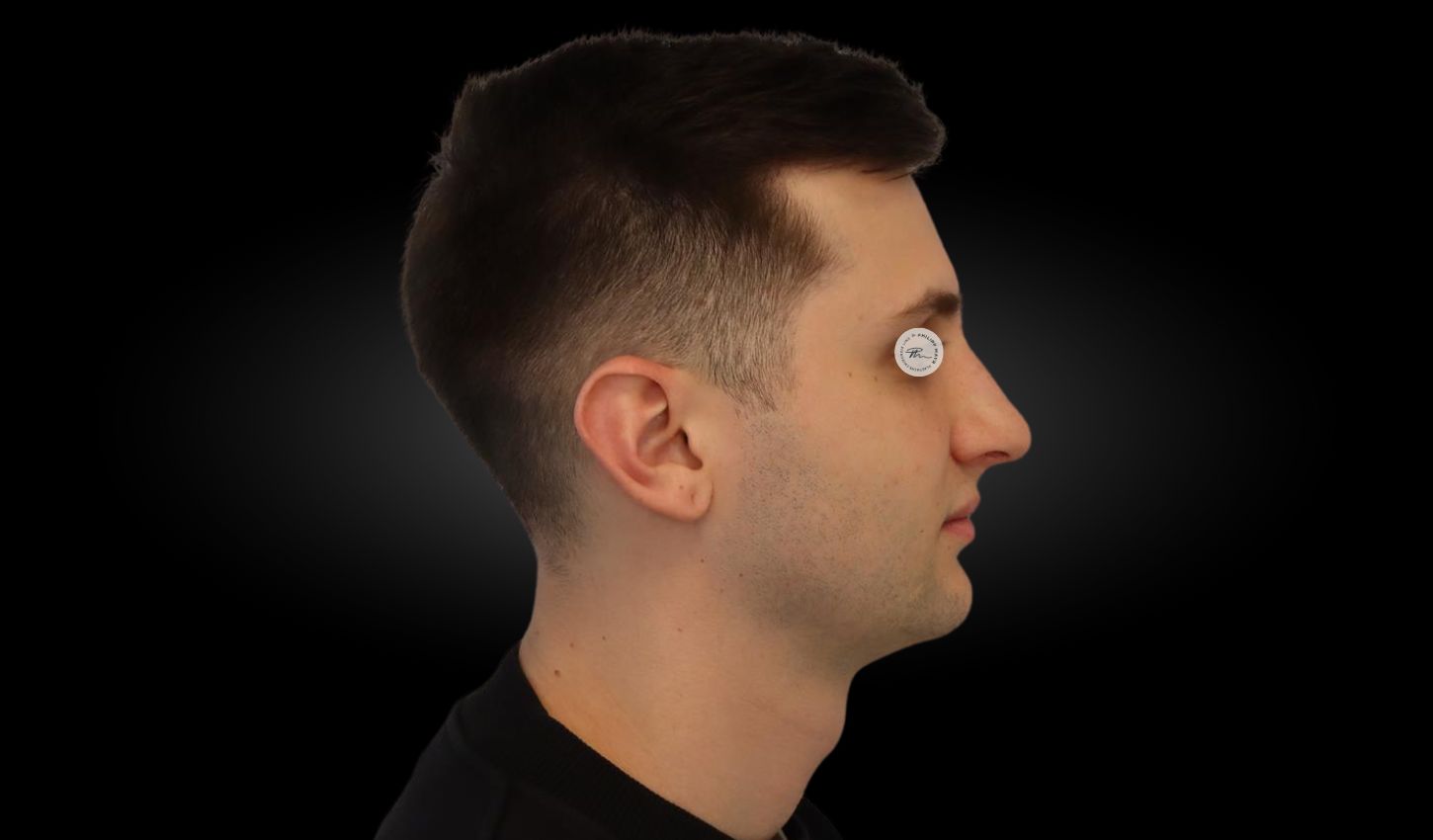 Danach