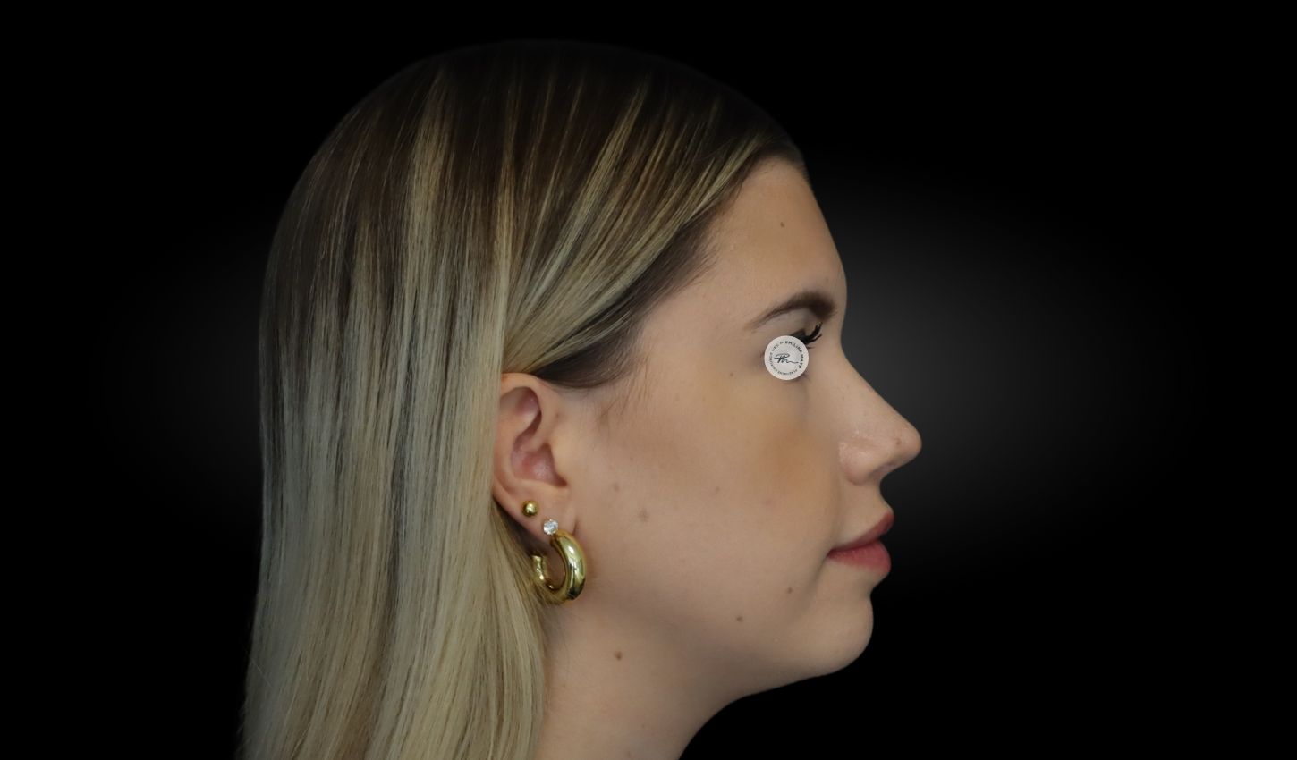 Danach
